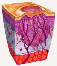 Wart cross-section illustration